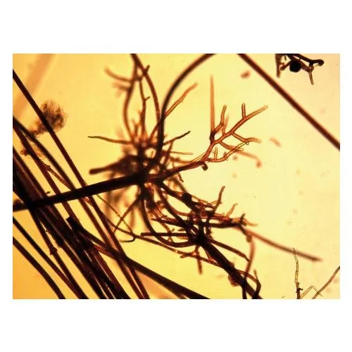 Плесневые грибы на продуктах питания